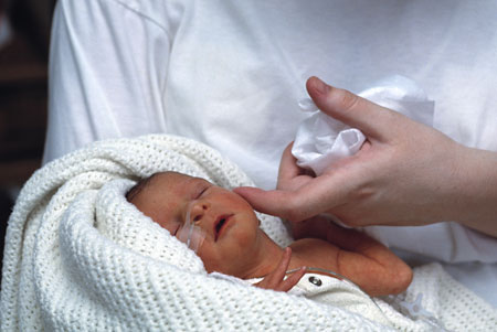 Kebutuhan dasar bayi prematur