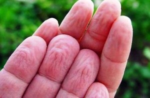 Mengapa Jari Keriput